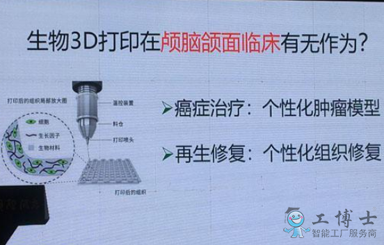 3D打印技術讓醫療產業進入個性定制時代